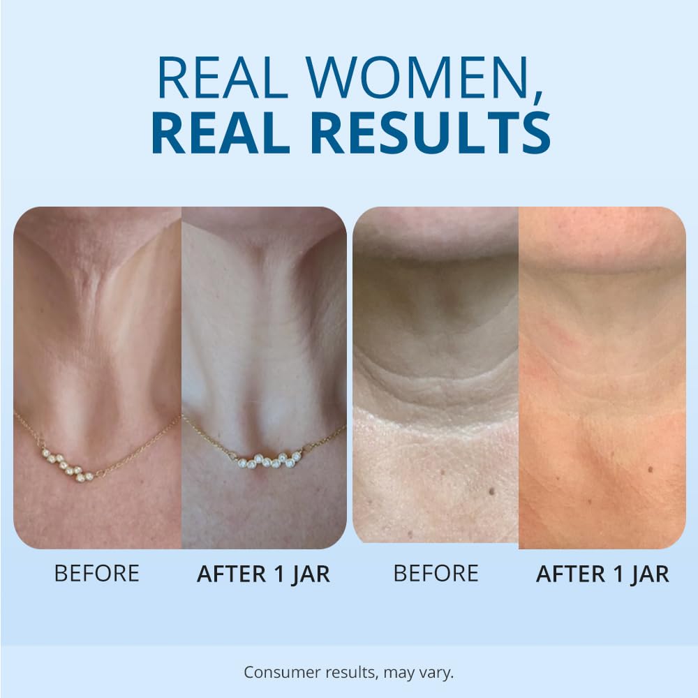 Tighten and Lift Neck Cream- Clinically Tested