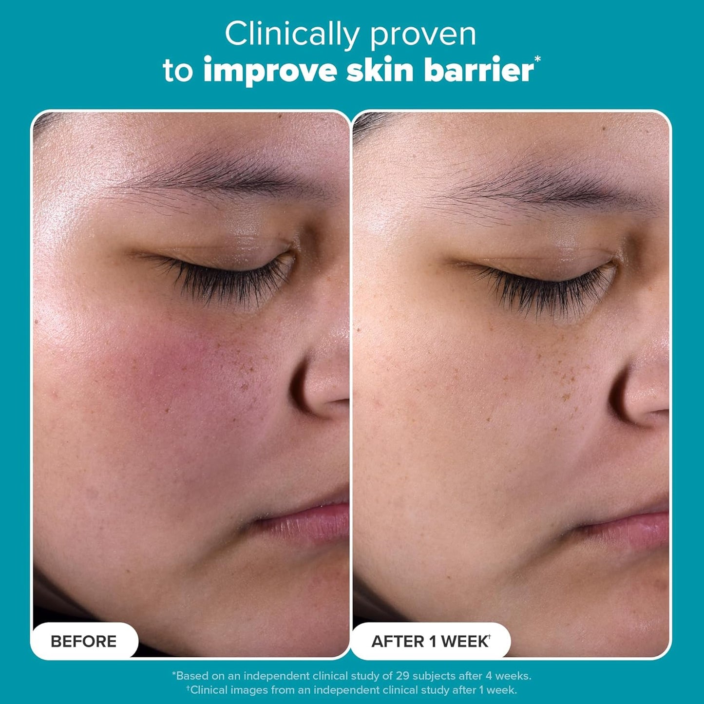 SKIN PERFECTING 2% BHA Liquid Salicylic Acid Exfoliant-Facial Exfoliant for Enlarged Pores, Wrinkles & Fine Lines, Suitable for Blackhead-Prone Skin, Fragrance-Free